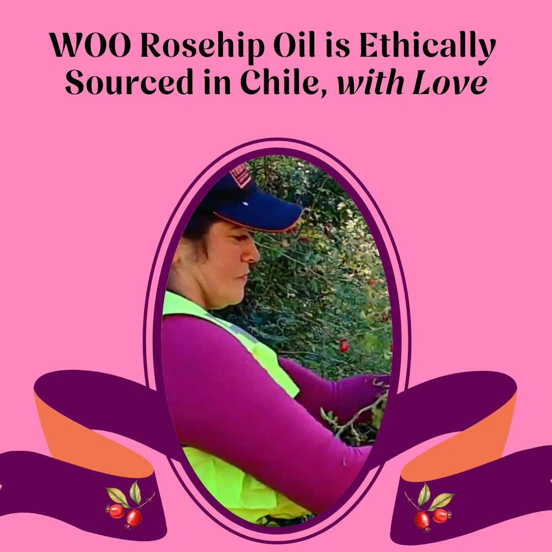 WOO Rosehip Oil - Hydrating, Anti-Aging, & Scar Reducing