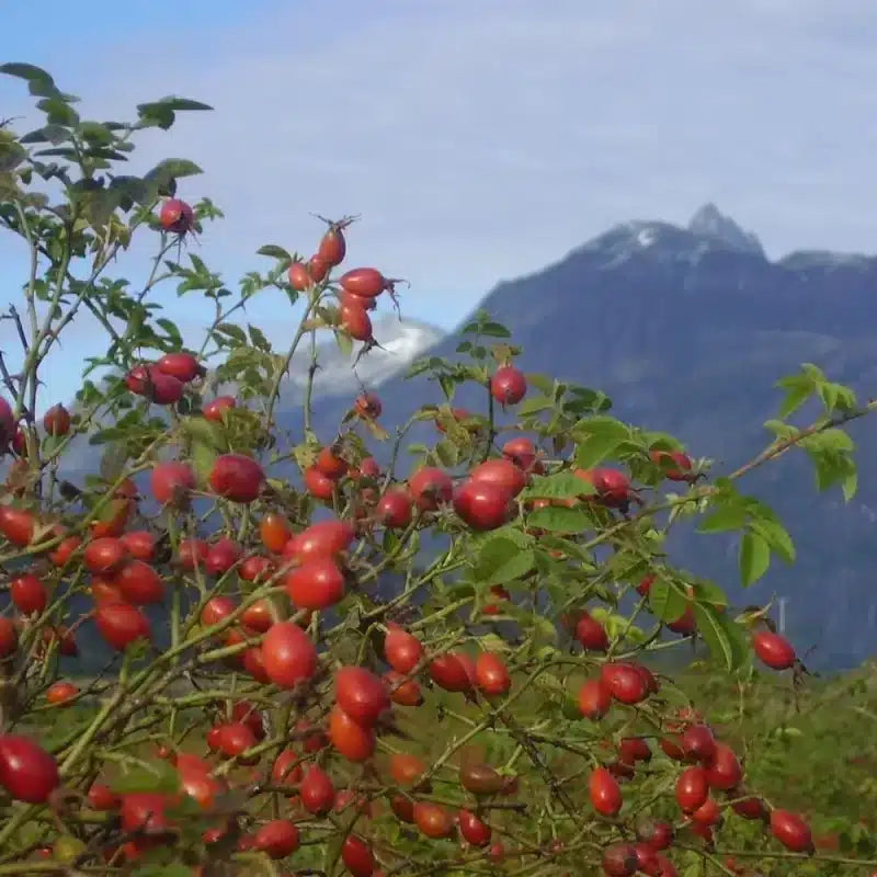 WOO Rosehip Oil - Hydrating, Anti-Aging, & Scar Reducing